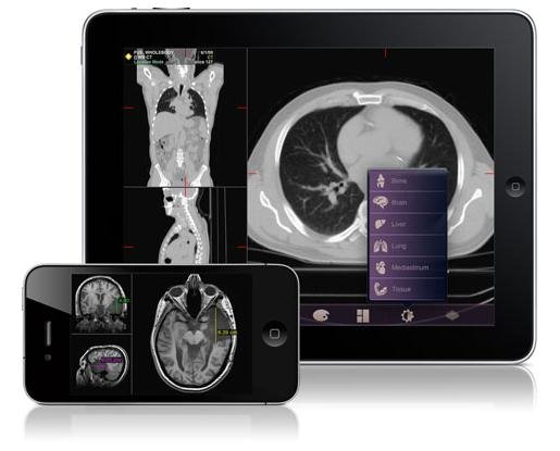 FDAͨ�^�ׂ�(g��)�t(y��)���\����(y��ng)�ó���Mobile MIM